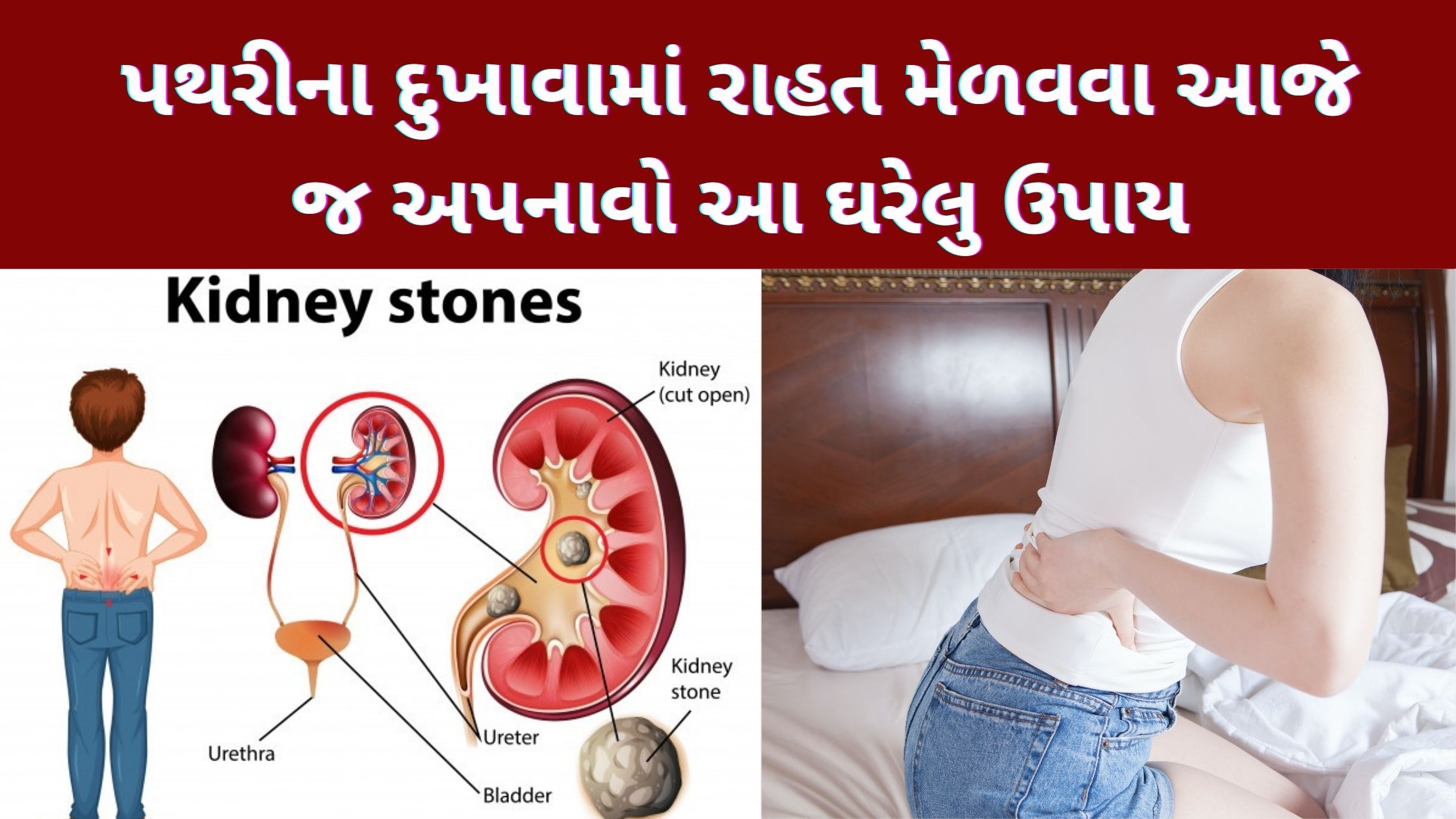 Home Remedies for Gallstones