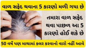 white hair reason in young age