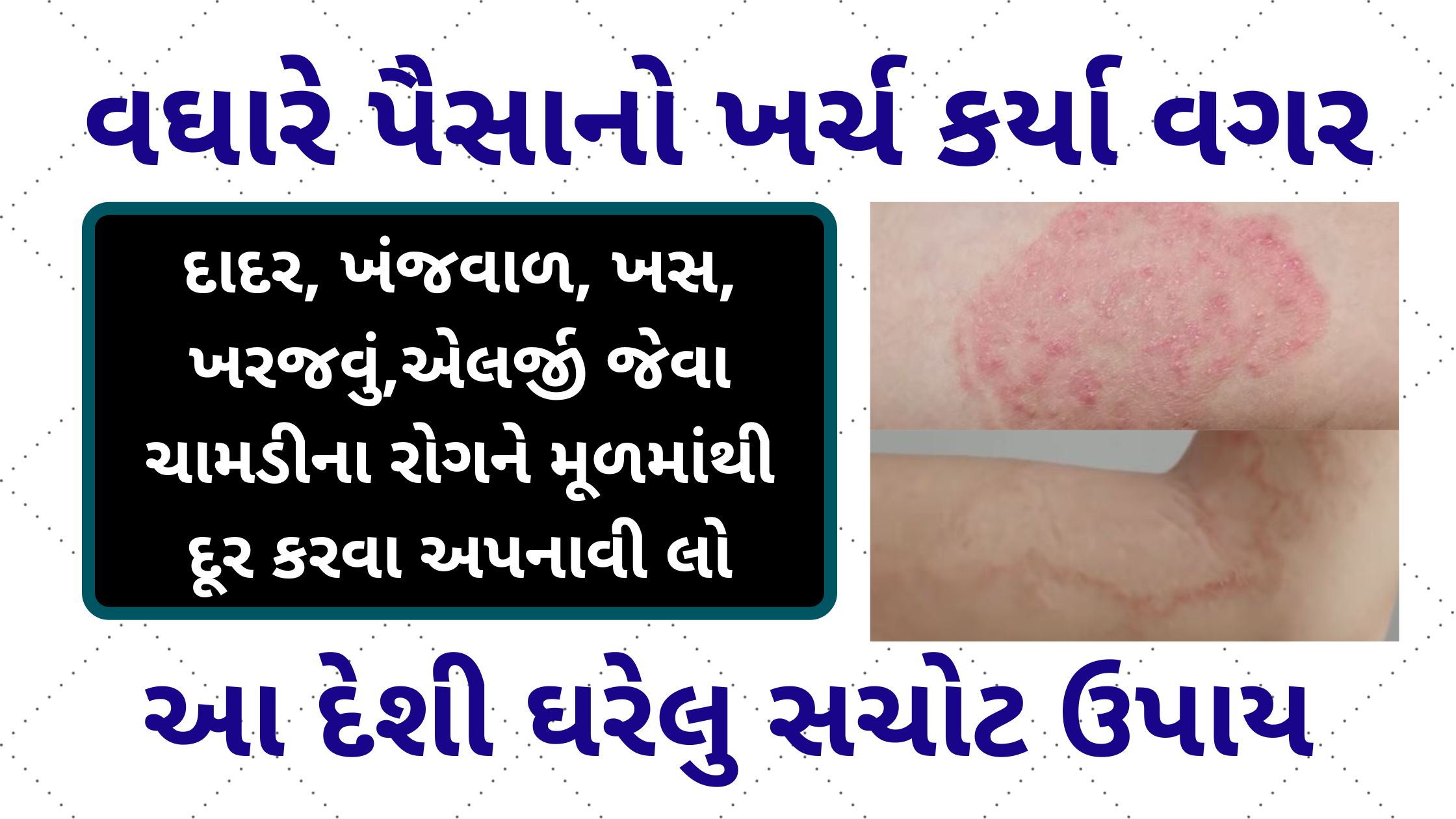 Home Remedies for Skin Diseases