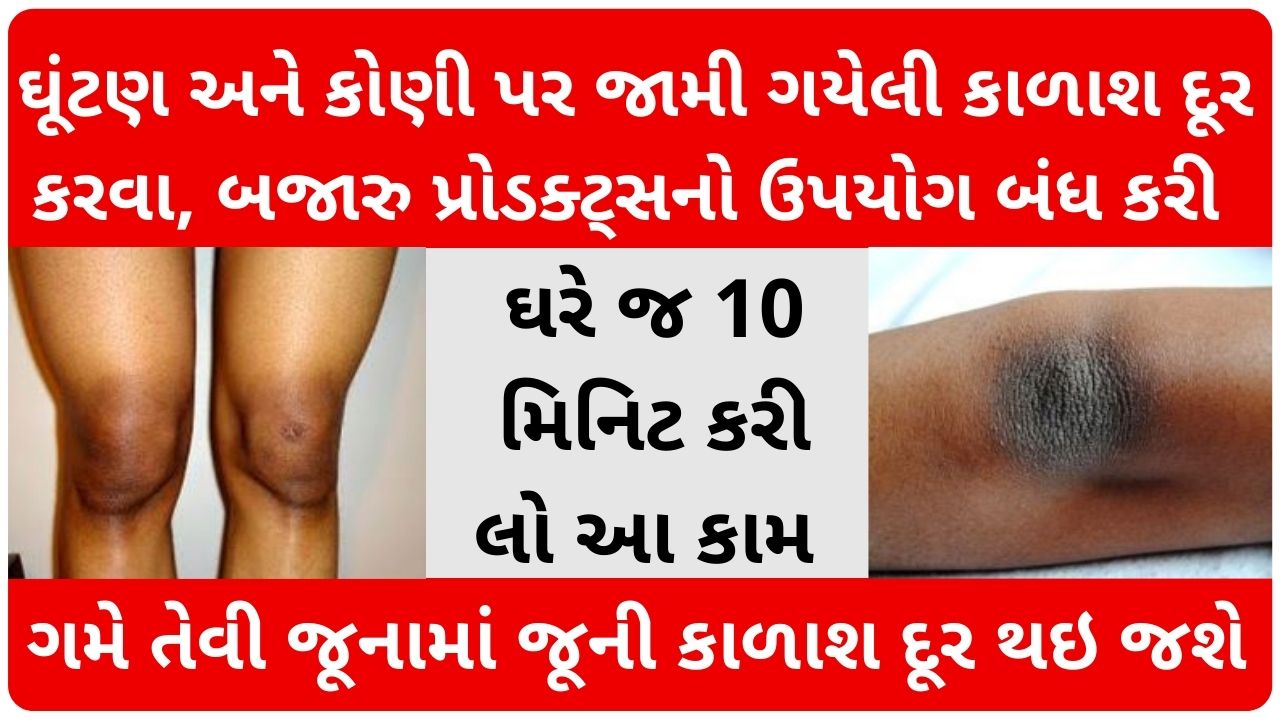 Remedies to remove blackness of knees and elbows