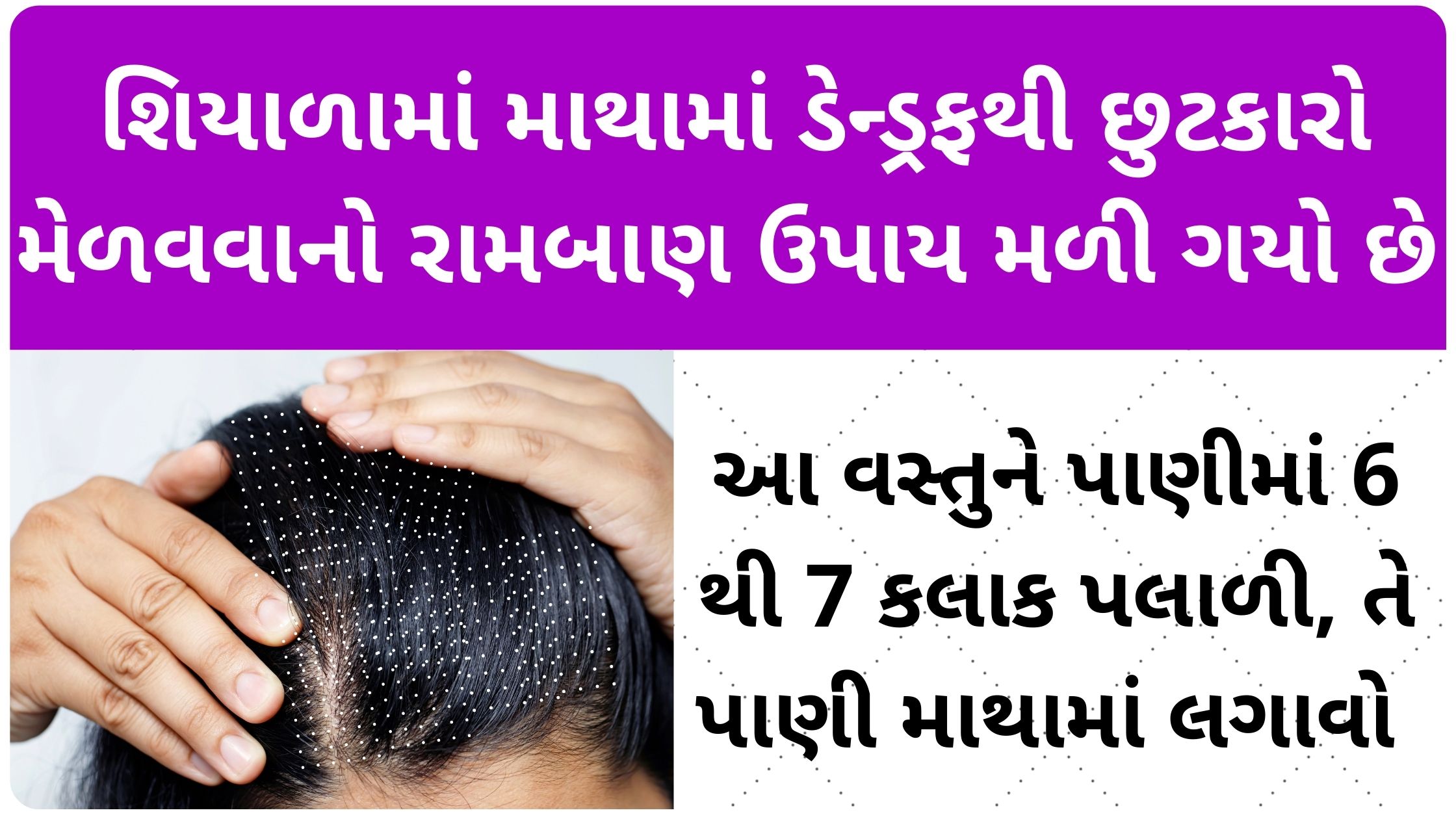 dandruff-solution-at-home