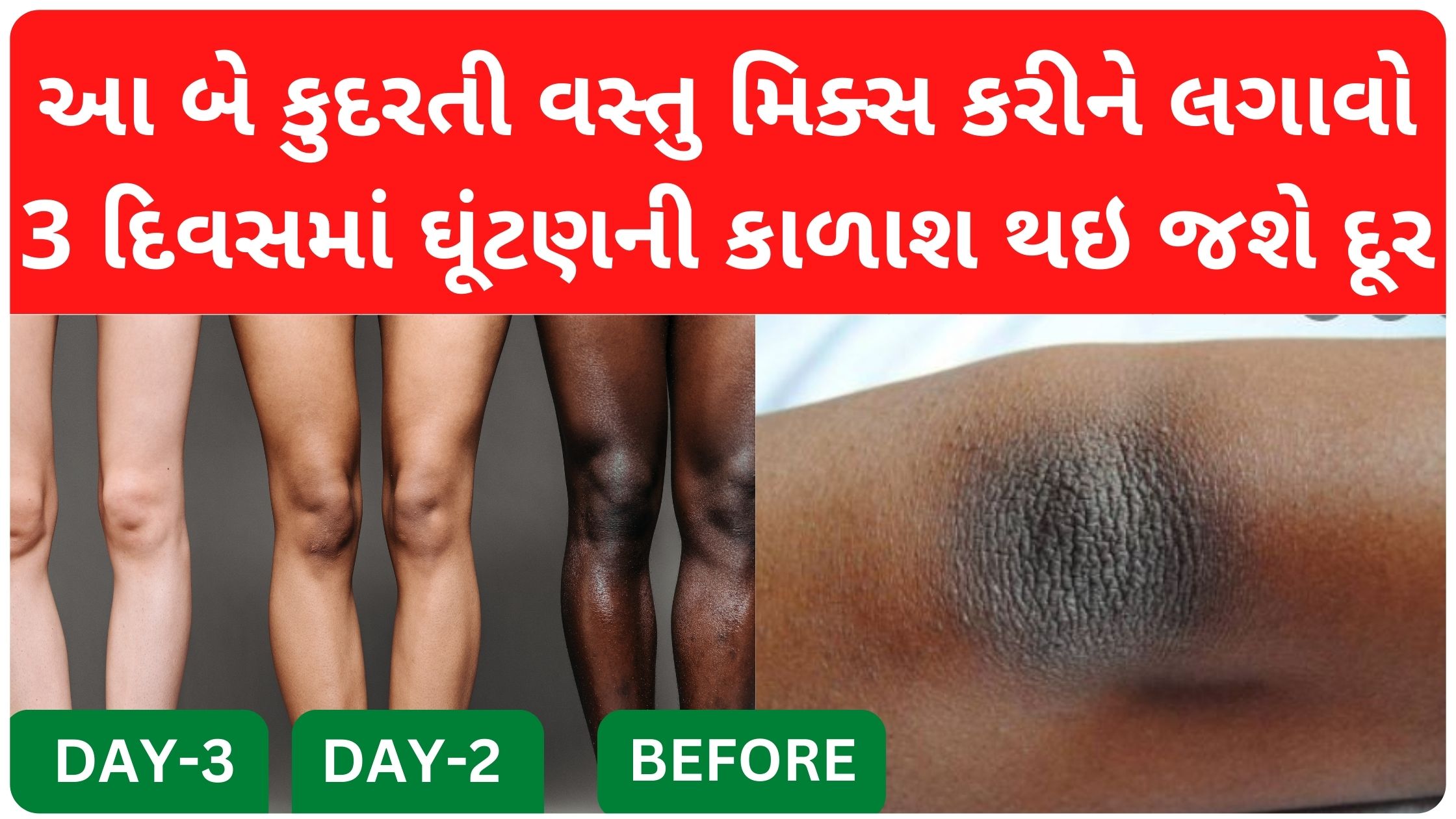 black knee solution at home remedies