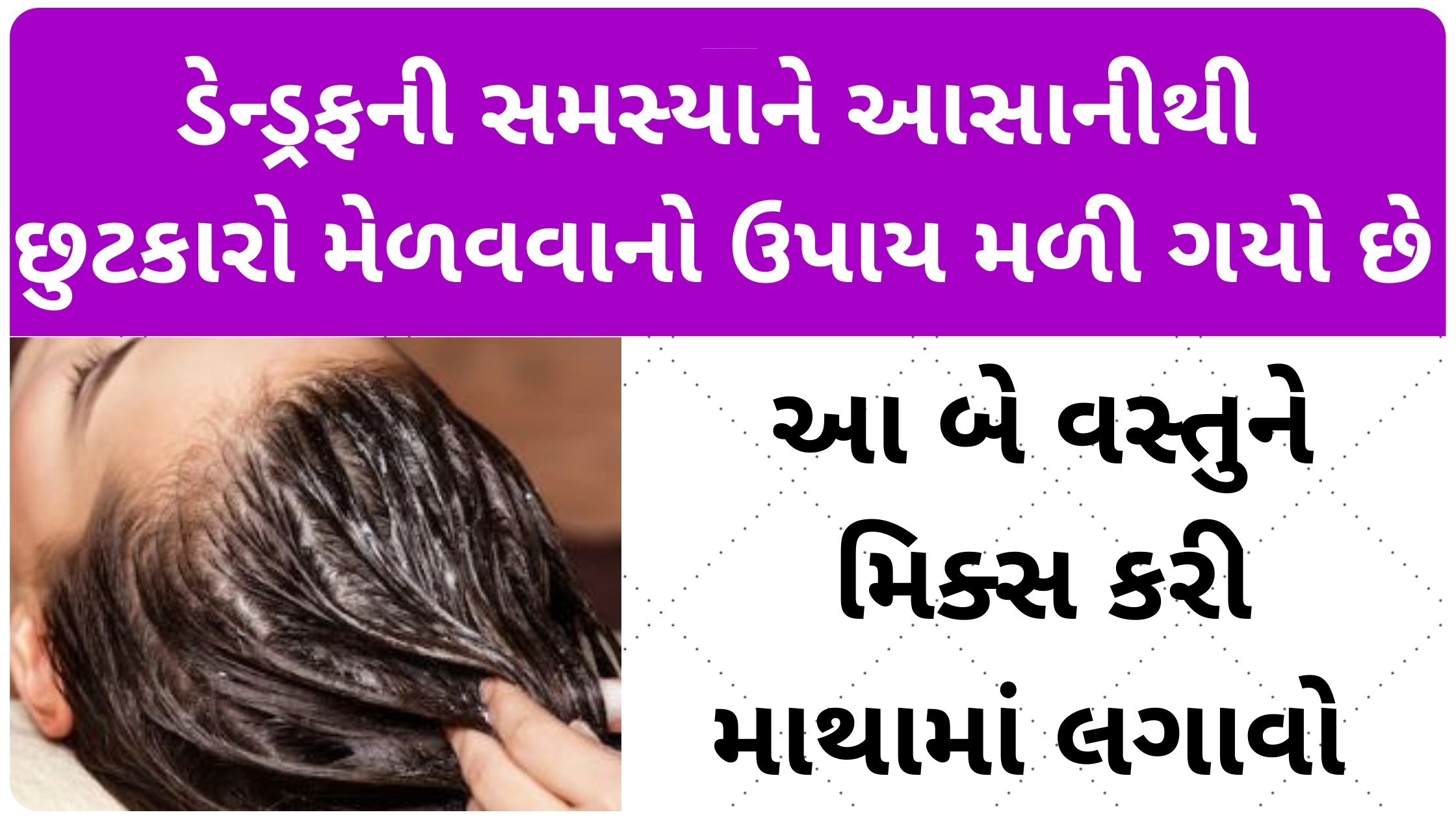 hair dandruff solution