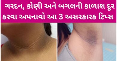 If neck and elbow blackness has taken away the beauty of the face, follow these 3 effective tips